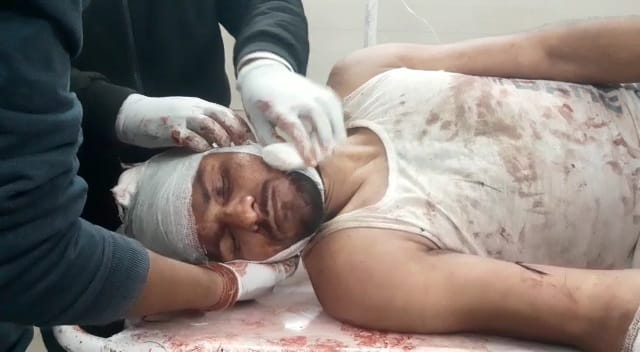 Youth missing from Hata collided with train in Damoh, both legs cut off