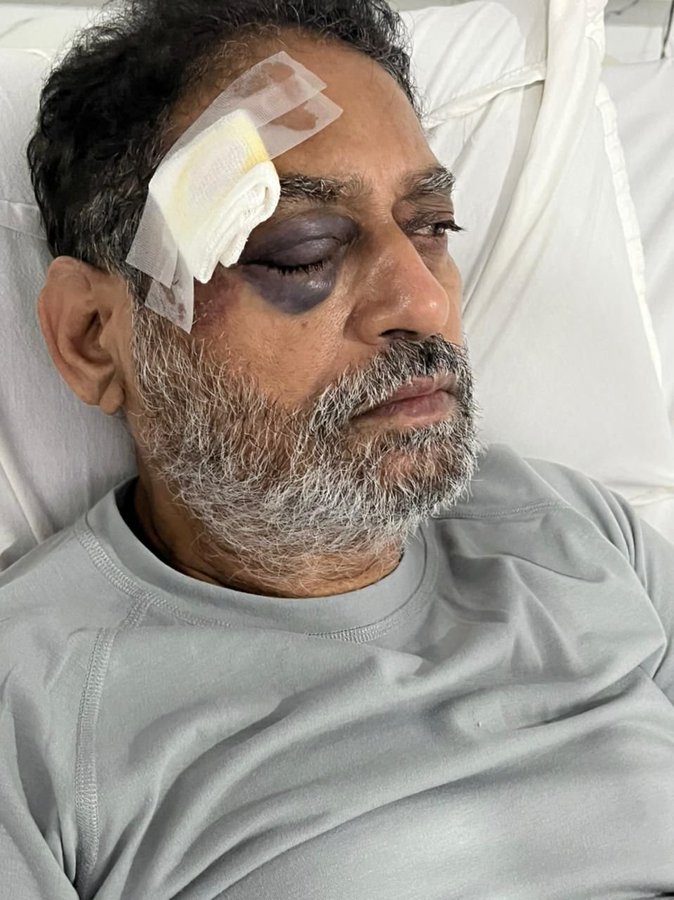 Congress leader injured in Bharat Jodo Yatra