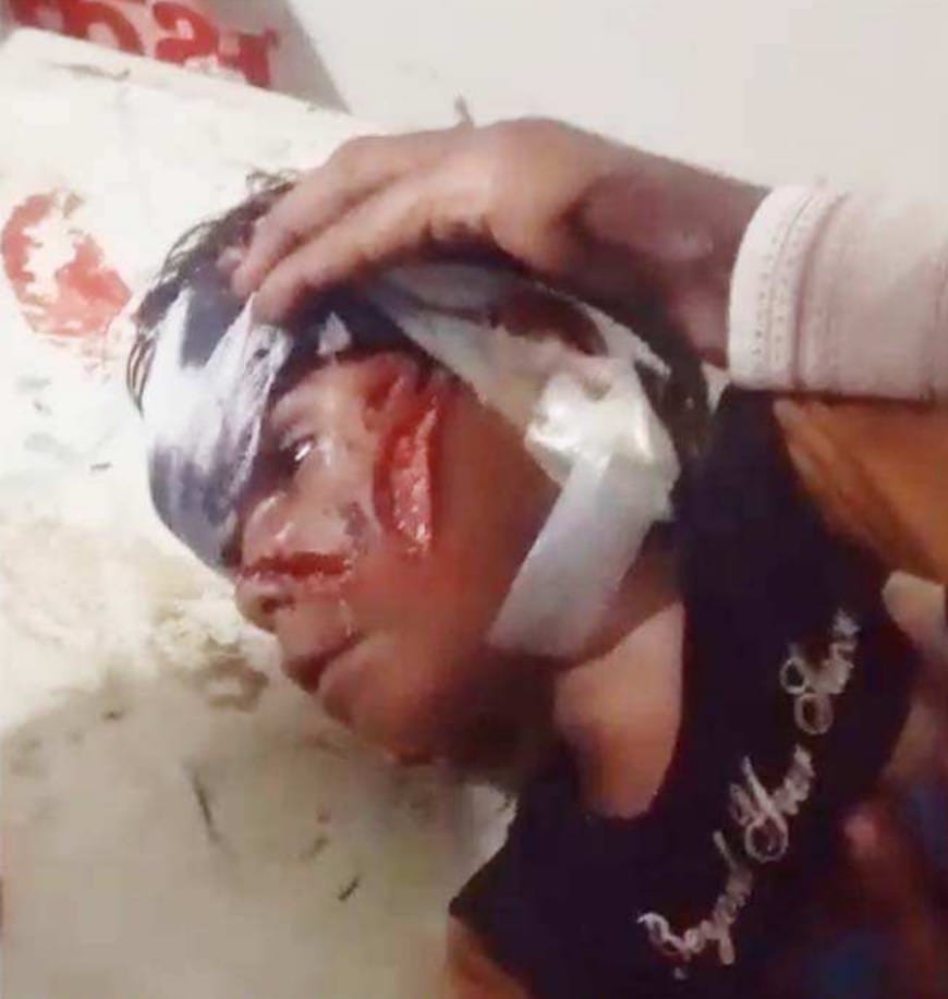 Uncle clashed with leopard to save nephew, both in critical condition