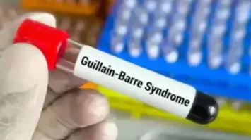 Panic due to GBS virus in Pune, Maharashtra