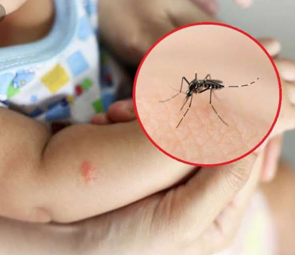 This time the health department is already on alert mode to deal with dengue