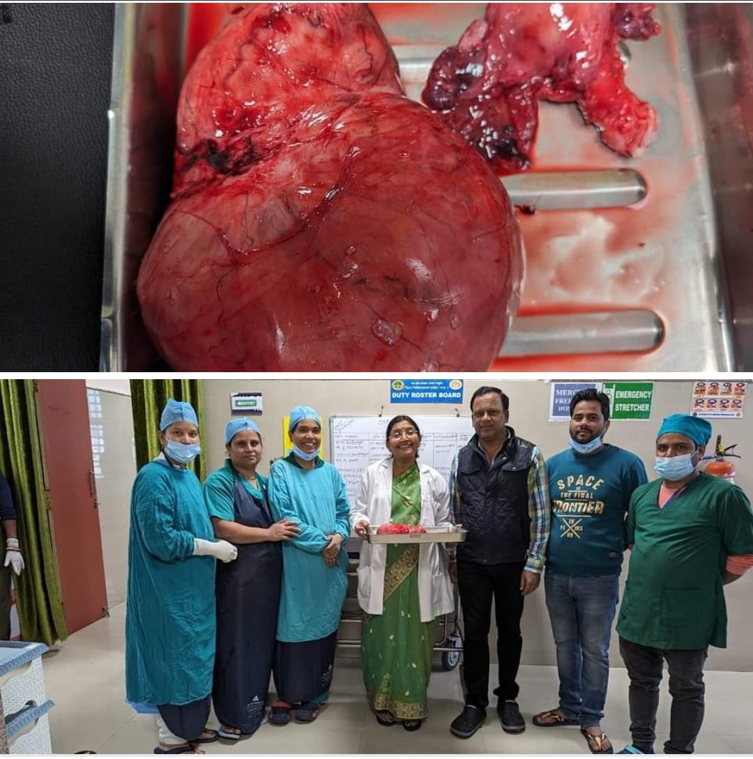 A woman was suffering from a large lump in her ovary in Damoh